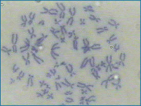 Cromossomas humanos ampliados 1000 vezes