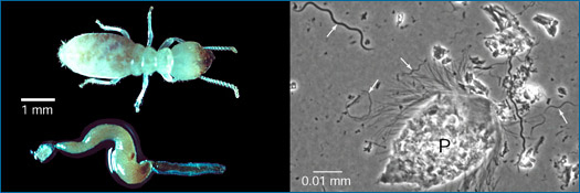protozoários e bactérias do intestino de uma térmita