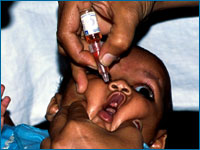 Uma criança recebe uma vacina oral contra a poliomielite.